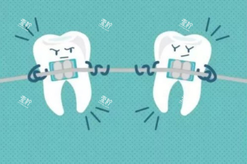 牙齿矫正卡通图.jpg 牙齿矫正卡通图.jpg
