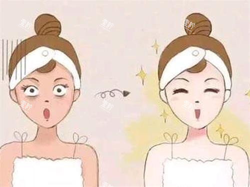光子嫩肤前后的对比.jpg 光子嫩肤前后的对比.jpg
