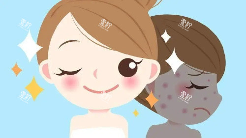 光子嫩肤后的成效.jpg 光子嫩肤后的成效.jpg