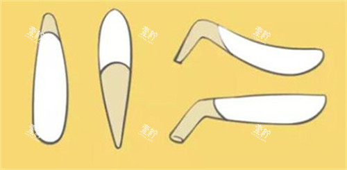 假体隆鼻展示照片.jpg 假体隆鼻展示照片.jpg