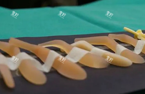 硅胶隆鼻假体照片.jpg 硅胶隆鼻假体照片.jpg