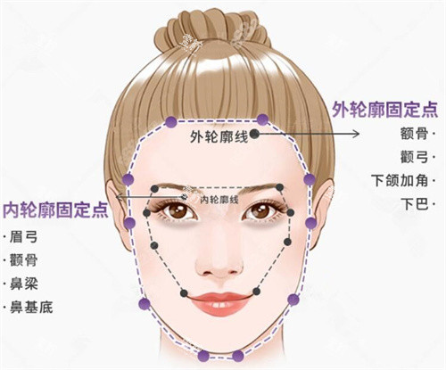 轮廓固定图示.jpg 轮廓固定图示.jpg