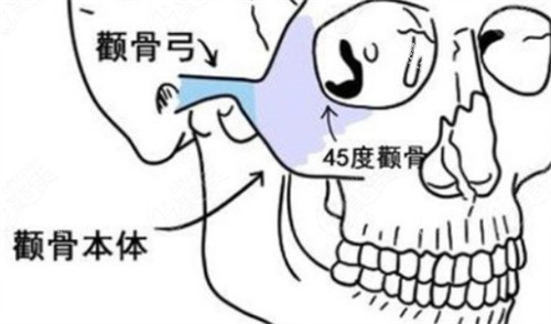 颧骨颧弓所在位置.jpg 颧骨颧弓所在位置.jpg