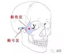 颧骨骨骼图.jpg 颧骨骨骼图.jpg