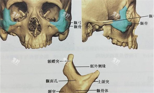 颧骨颧弓位置展示图.jpg 颧骨颧弓位置展示图.jpg
