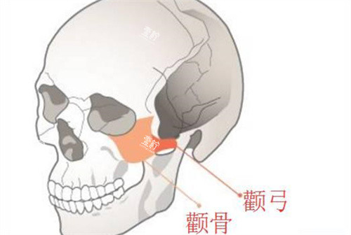 颧骨与颧弓位置动画图.jpg 颧骨与颧弓位置动画图.jpg