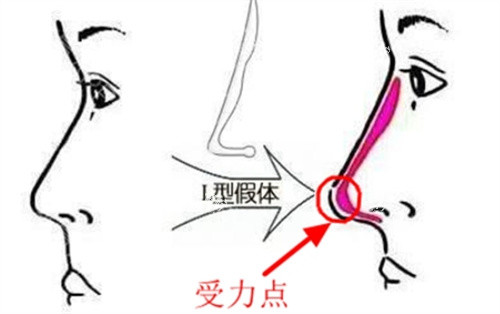牛克辉做鼻子风格到底有何特别？自然妈生感与面部比例协调，是其核心审美理念