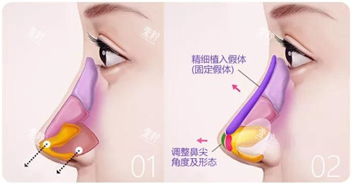 鼻综合示意图.jpg 鼻综合示意图.jpg