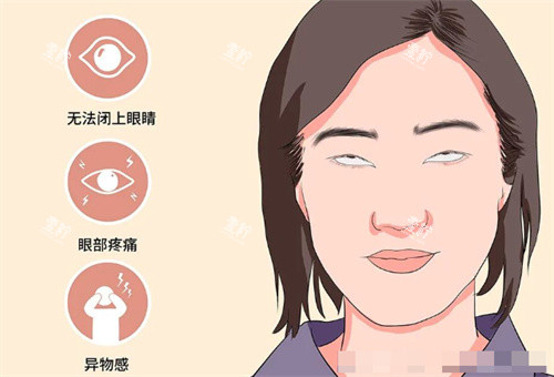 需要做眼修复的情况.jpg 需要做眼修复的情况.jpg