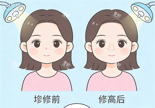 鼻修复前后的对比.png 鼻修复前后的对比.png