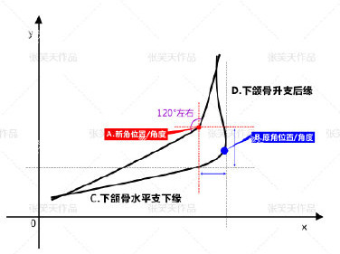 北京圣嘉新医疗美容医院张笑天下颌角手术设计.jpg
