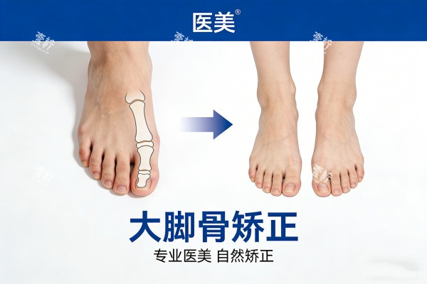 大脚骨矫正前后对比图.jpg