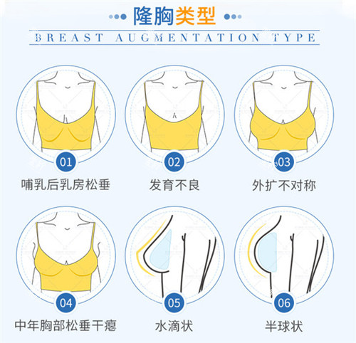 假体隆胸适应症.jpg
