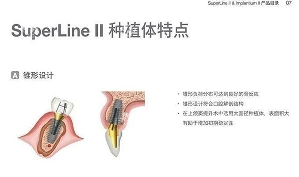 登腾二代种植体特色图片.jpg