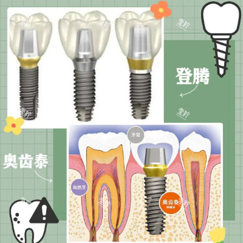 登腾奥齿泰动画图.jpg