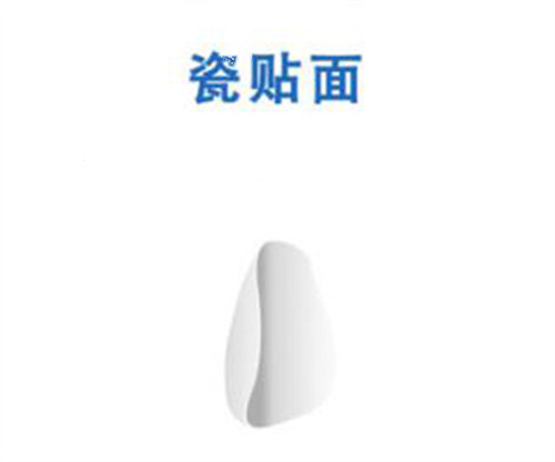 瓷贴面修复改善图.jpg 瓷贴面修复改善图.jpg