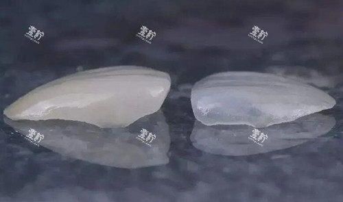 瓷贴面修复对比.jpg 瓷贴面修复对比.jpg