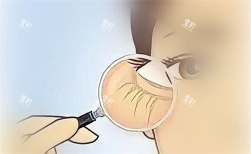 眼部细纹放大展示图.jpg.jpg 眼部细纹放大展示图.jpg.jpg