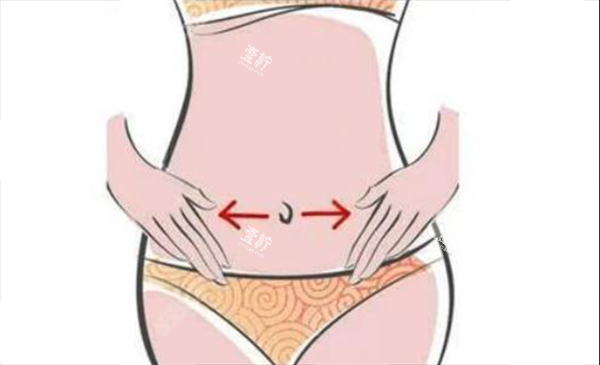 腹壁成形术2.png 腹壁成形术2.png