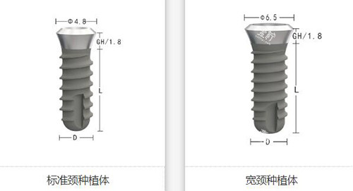 zdi种植体植牙如何.jpg zdi种植体植牙如何.jpg