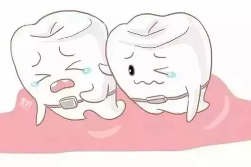 牙齿矫正卡通.jpg