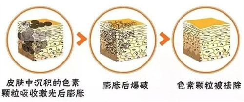 超皮秒原理.jpg 超皮秒原理.jpg