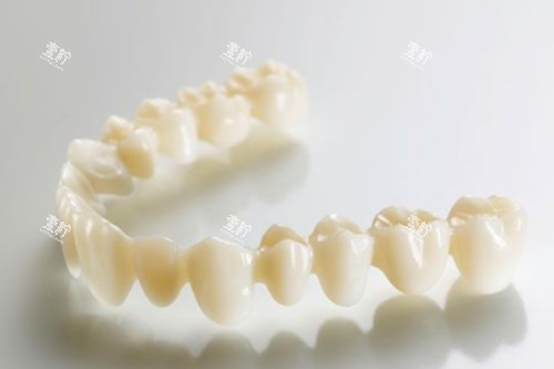 全瓷牙冠卡通图片展示.jpg