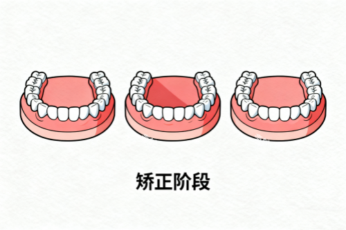 牙齿矫正成果展示.png 牙齿矫正成果展示.png