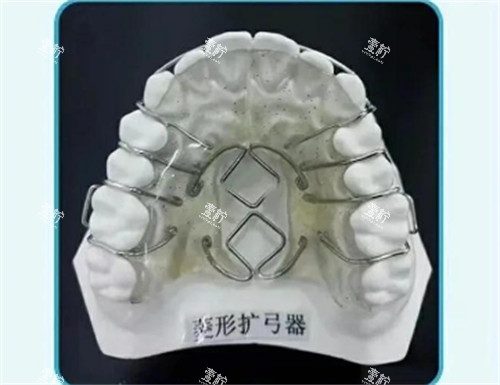 菱形扩弓器怎么样.jpg 菱形扩弓器怎么样.jpg