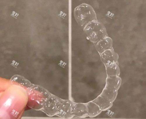 隐形牙齿矫正器.jpg 隐形牙齿矫正器.jpg