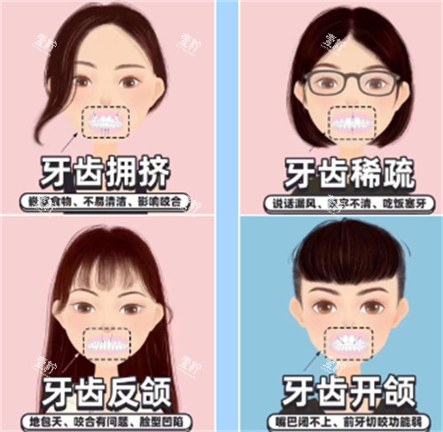 牙齿矫正自查表.jpg 牙齿矫正自查表.jpg
