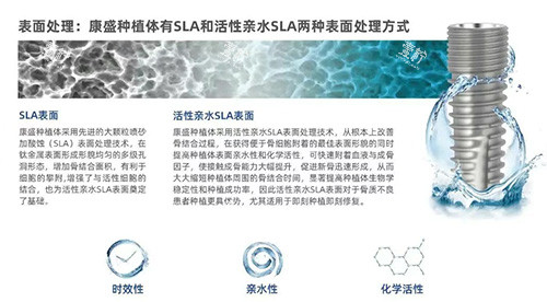 康盛种植牙表面设计图片.jpg 康盛种植牙表面设计图片.jpg