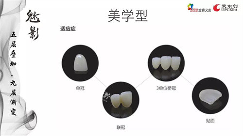 爱尔创全瓷牙魅影美学型适应症.jpg