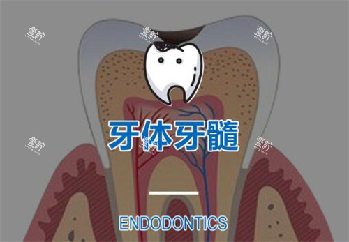 根管治疗改善图.jpg