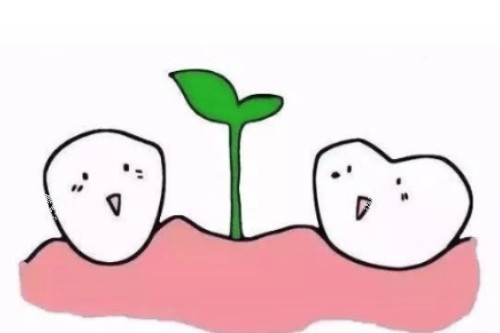 种植牙概念图.jpg