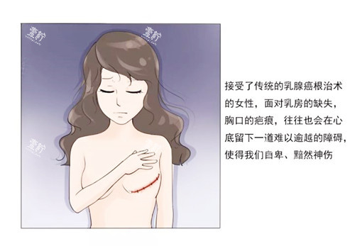 乳房重建手术.jpg