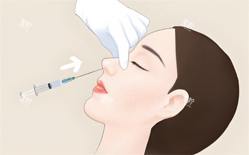 注射隆鼻.jpg 注射隆鼻.jpg