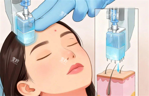 热玛吉操作卡通图片.jpg 热玛吉操作卡通图片.jpg