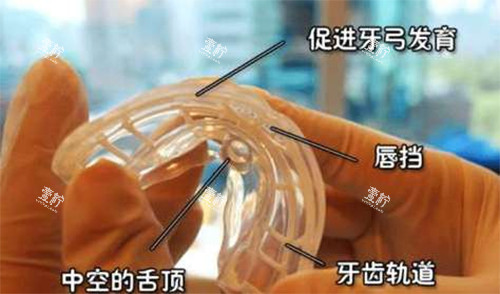 矫治器材料解析.jpg