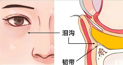 泪沟填充卡通图.jpg