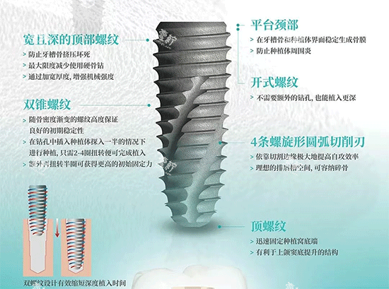 韩国伊诺种植牙植体照片.png 韩国伊诺种植牙植体照片.png