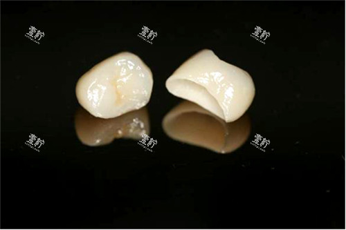 两颗全瓷牙冠实物图.jpg
