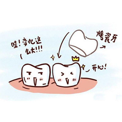 烤瓷牙冠卡通图展示.jpg