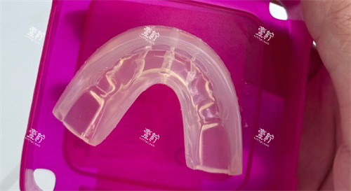 罗慕儿牙矫治器.jpg