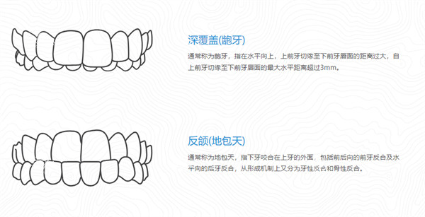 美婕氏牙齿矫正器适应症.jpg