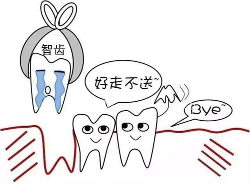 拔智齿示意图.jpg