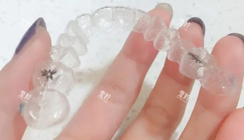 时代天使牙套照片.jpg 时代天使牙套照片.jpg