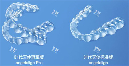 时代天使隐形牙套.jpg 时代天使隐形牙套.jpg