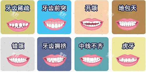 牙齿矫正不同适应症漫画图.jpg 牙齿矫正不同适应症漫画图.jpg