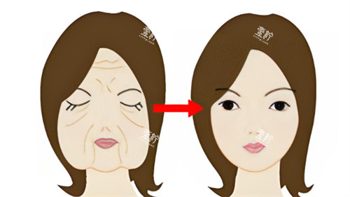 面部抗衰前后对比.jpg 面部抗衰前后对比.jpg